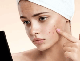 Menyembuhkan jerawat meradang