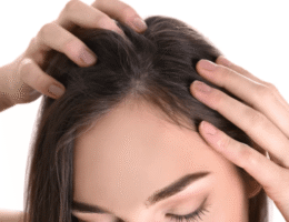 Persiapan Transplantasi Rambut