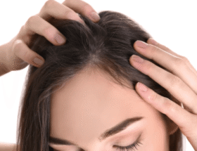 Persiapan Transplantasi Rambut