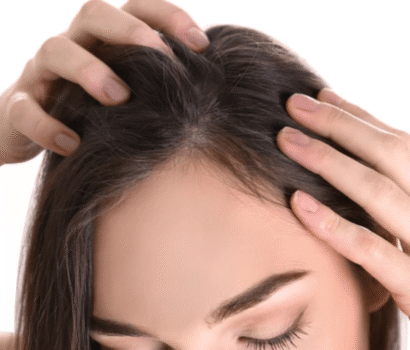 Persiapan Transplantasi Rambut