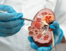 Transplantasi Ginjal