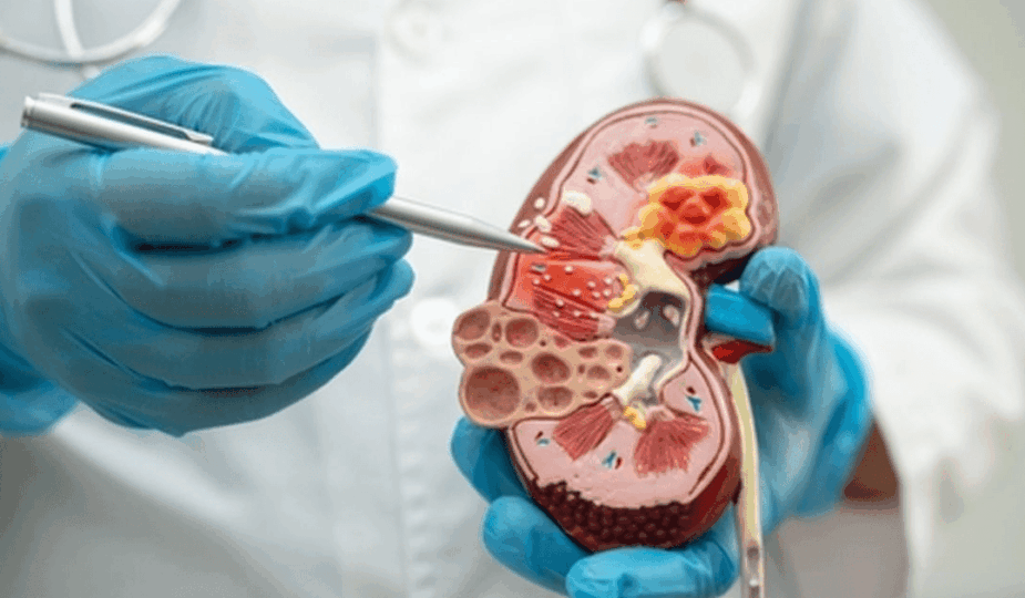 Transplantasi Ginjal