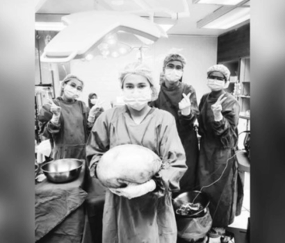 Kista Perut 8 Kg Wanita