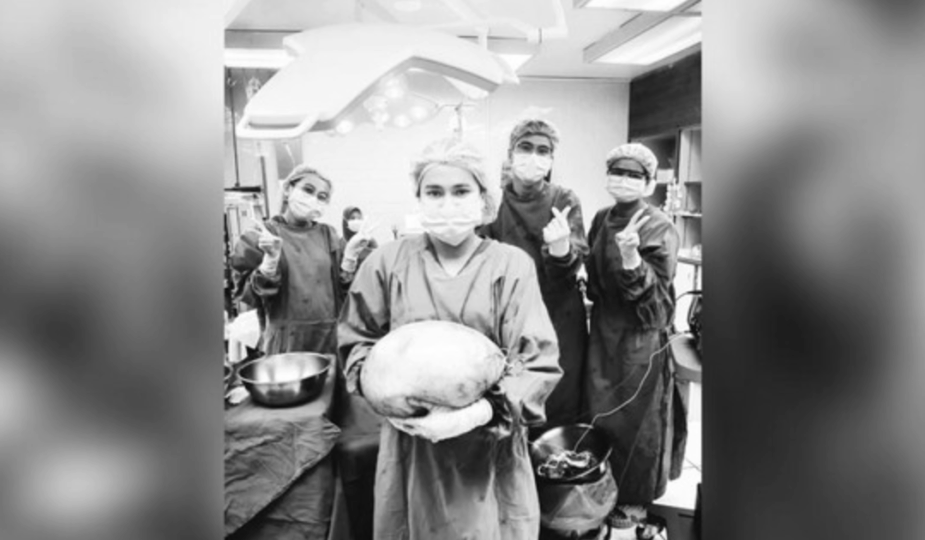 Kista Perut 8 Kg Wanita