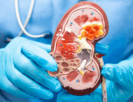 Perubahan Warna Urine